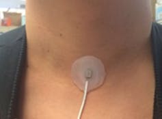 Closeup of a person's neck with a small round patch near the base of the neck with a white wire leading down from it